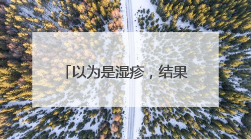 以为是湿疹，结果竟是癌！医生：很多人去错科室！